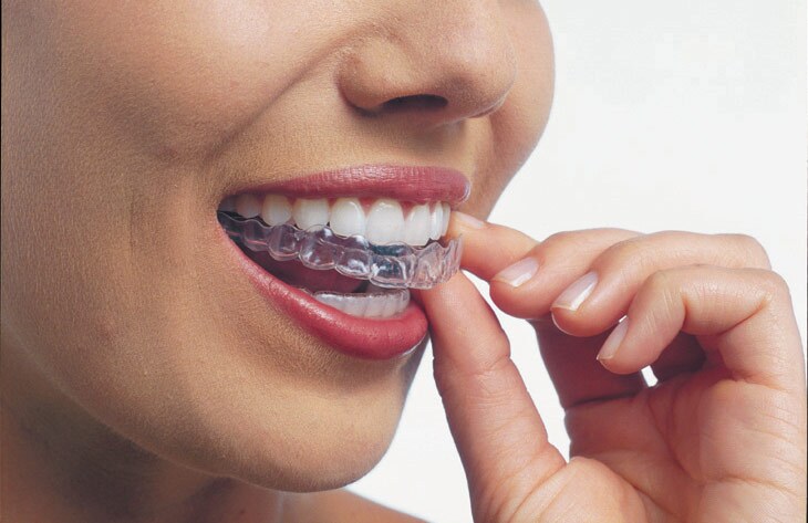 ccInvisalign-b